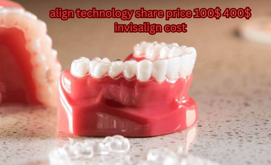 align technology share price 100 400 invisalign cost