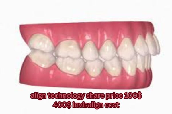 align technology share price 100 400 invisalign cost